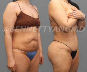 20140403_09574_before_after