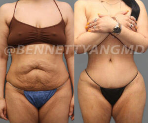 20140403_09726_before_after