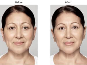 BBL Maryland Plastic Surgeon Bennett C. Yang