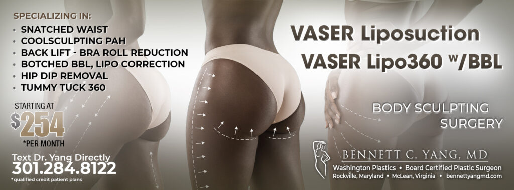 Vaser Lipo 360 BBL Vaser Liposuction near me